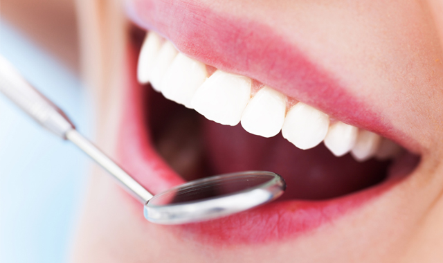 治療後は定期検診で口腔内の健康を維持する