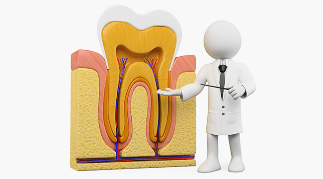 根管治療とは？