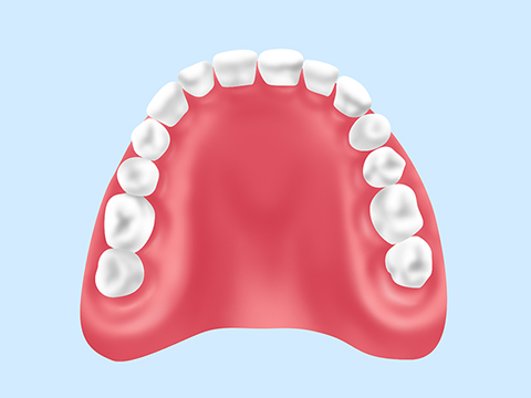 プラスチックの入れ歯（保険診療）